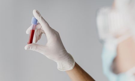 back-view-doctor-holding-a-blood-sample